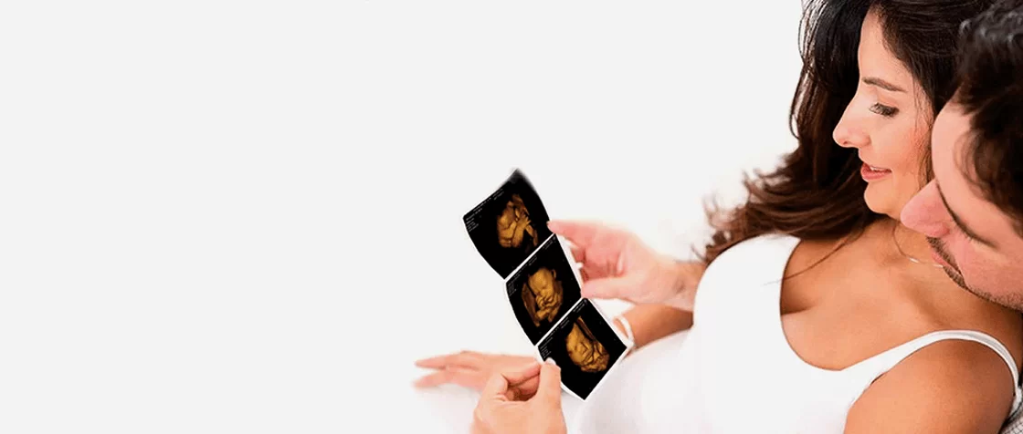 Bonding With Your Baby via 4D Ultrasound